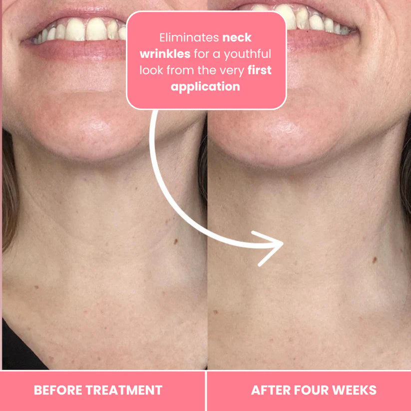 Korean Bio-Collagen Necklift Mask - Younger Neck After 1 Use