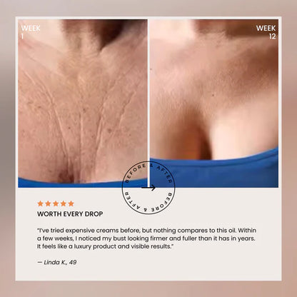 Naturally Lifted, Fuller Bust - Without Surgery, Pills or Padding